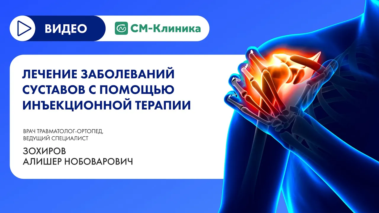 Лечение суставов плазмой крови - цены в Москве, запись на АСР-терапию в  медицинском центре «СМ-Клиника»