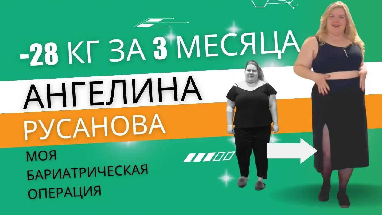 Лечение ожирения – цены в Москве, центр лечения ожирения в медицинском  центре «СМ-Клиника»